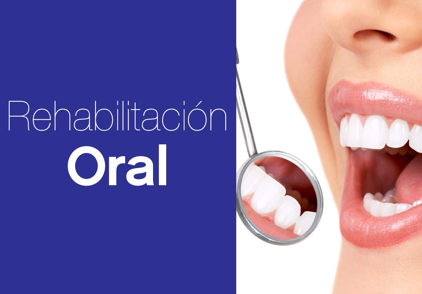 Rehabilitacion oral